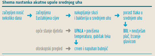 Shema nastanka akutne upale srednjeg uha - Littledot